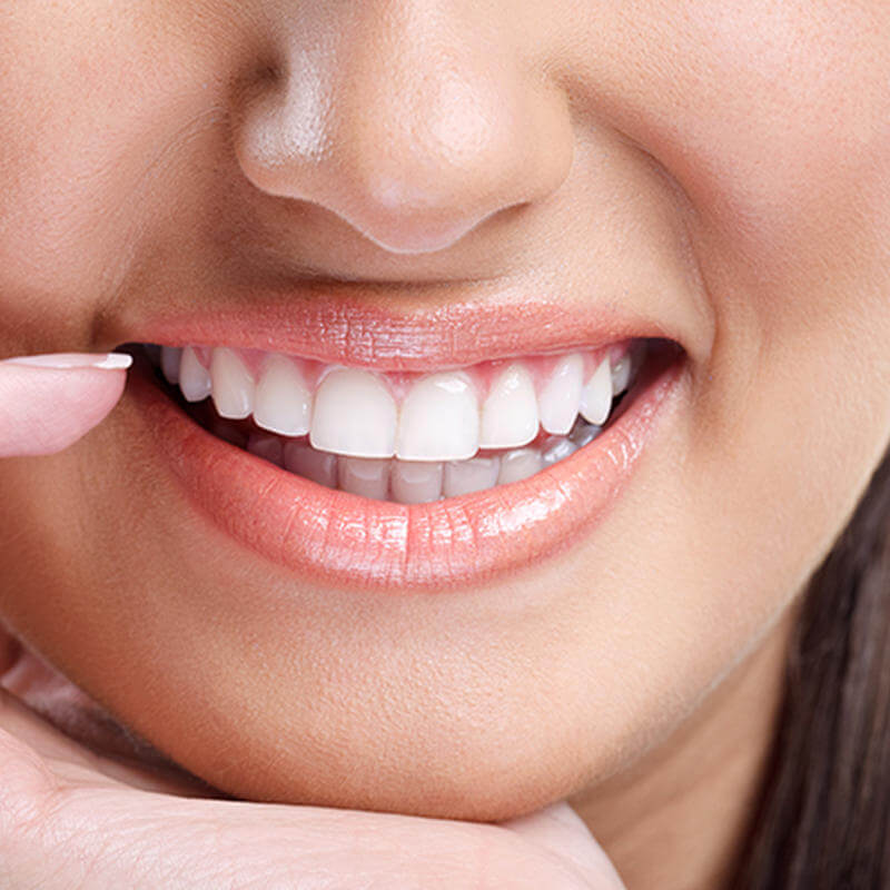 5 dicas para manutenção de resinas