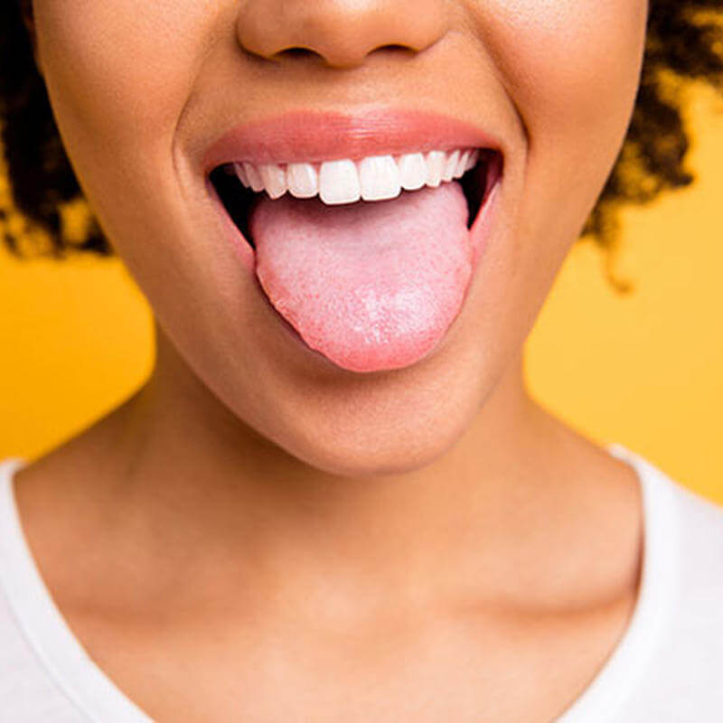 5 problemas da falta de higienização da língua