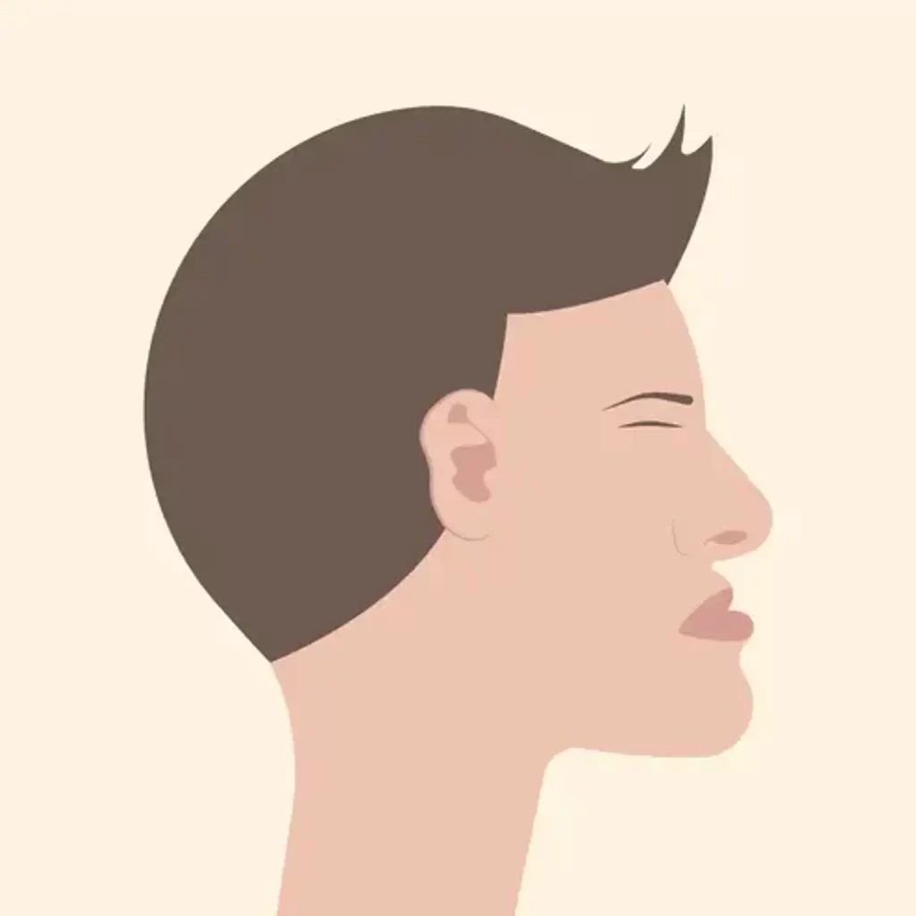 Cirurgia de Retração Mandibular