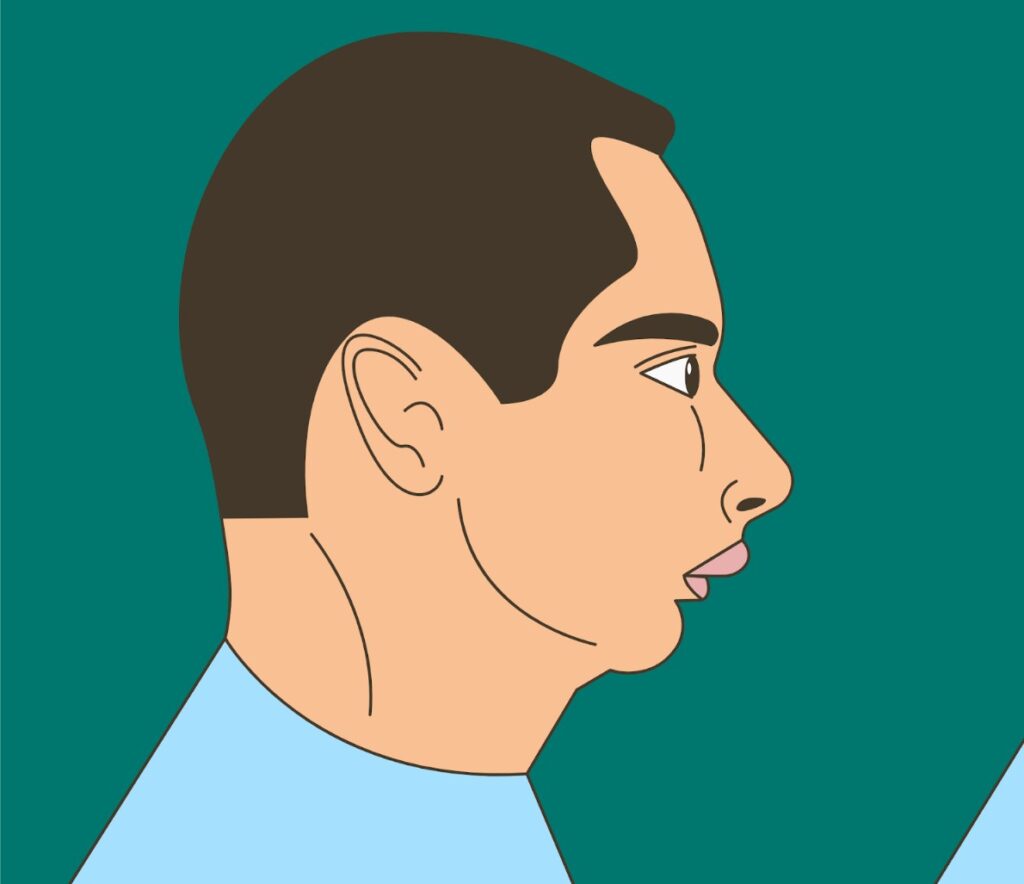 Cirurgia queixo para frente